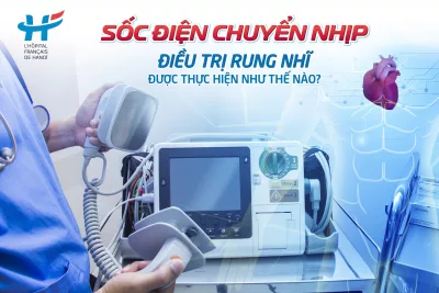 Sốc điện chuyển nhịp trong điều trị rung nhĩ được thực hiện như thế nào?